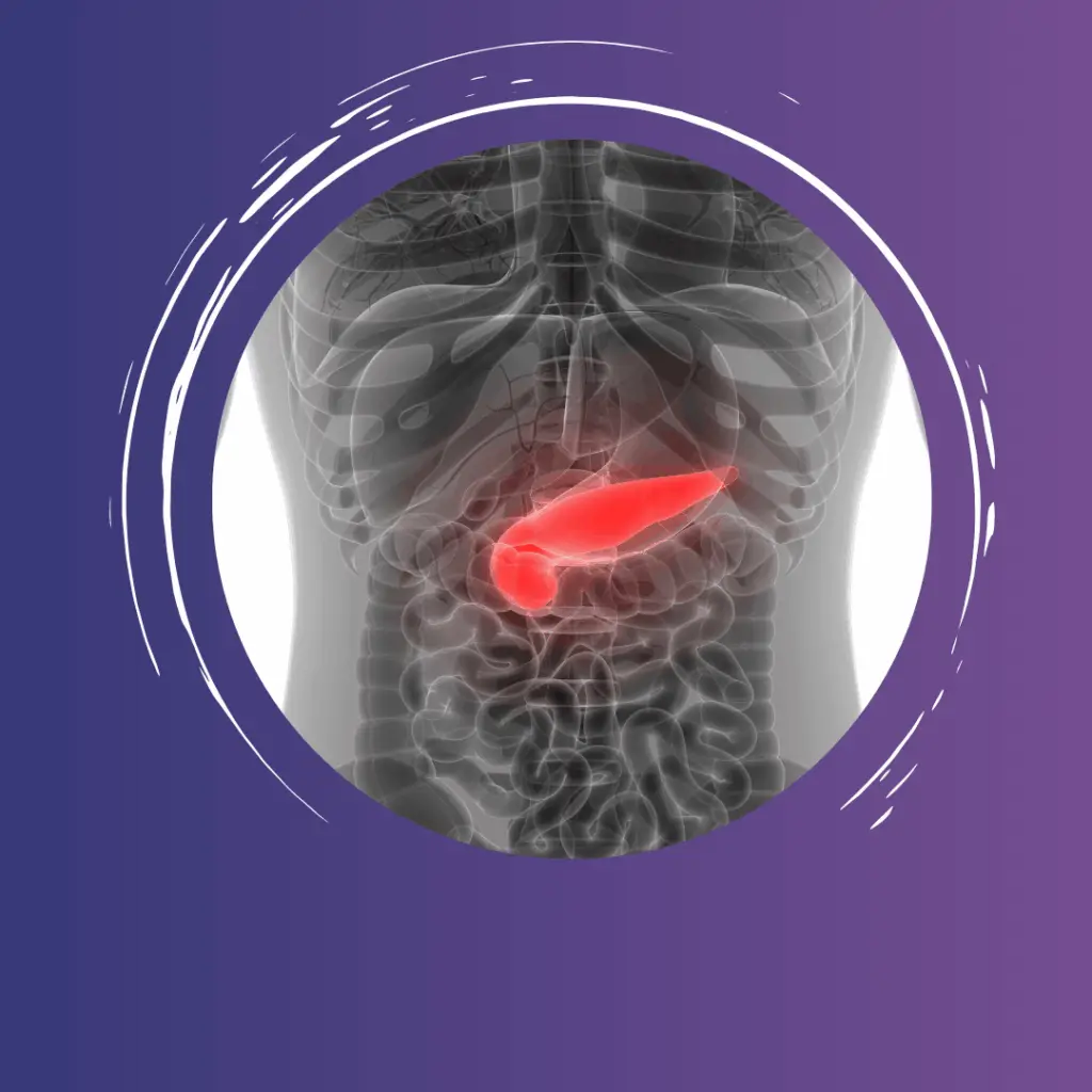 Illustration of pancreatic cancer symptoms